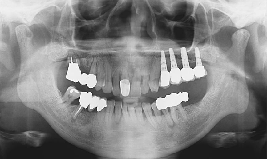 3. Clinical Cases Case 2.