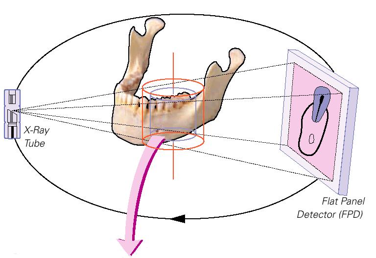 Veraviewepocs 3D ÇEKİM PRENSİBİ Cone Beam DVT