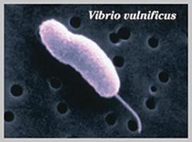 Yapılan son çalışmalar, patojen Vibrio türlerinin
