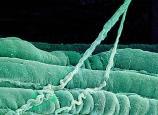 Kamil 100 ÖZER deg Golgi Tendon Organı Bu proprioseptör tendon fibrillerinde ve kastendon bağlantılarına yakın yerleşmiştir.