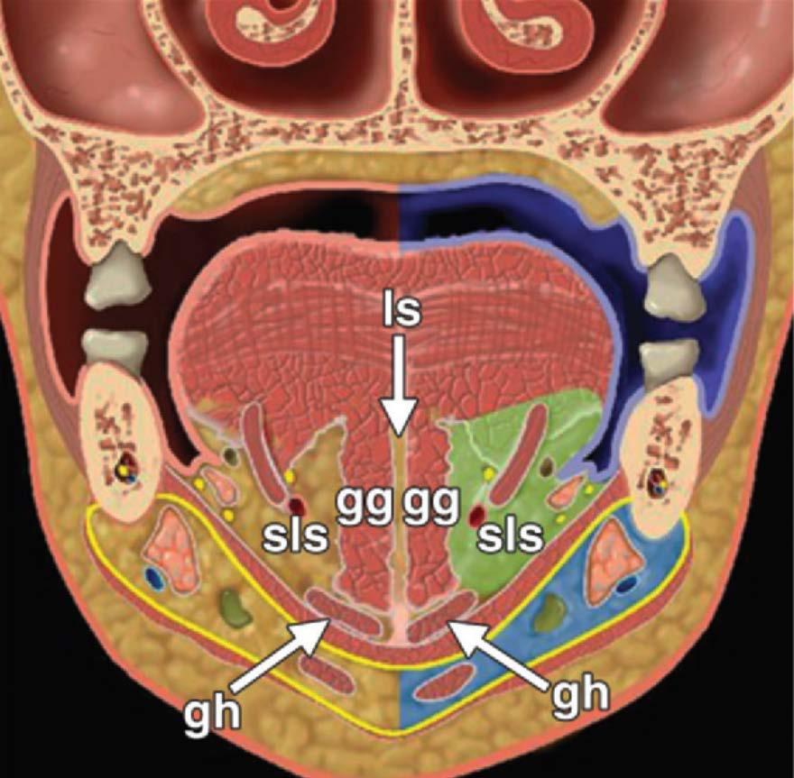 Linguler septum Geniohiyoid kaslar Genioglossus kaslar