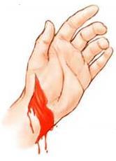 10 Kanamanın Kaynağına Göre Ven (Toplardamar) Kanamaları: Venler, hücrelerden dönen kanı kalbe taşıyan ve düşük basınçlı kan akımına sahip