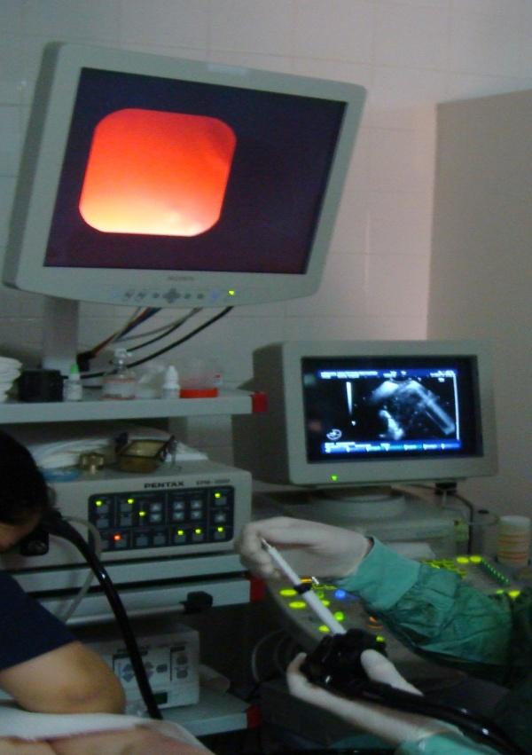 Endoskopik ultrason merkezi görüntü Resim 8.