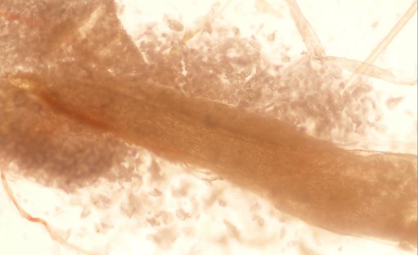 Şekil 2.2.1. Uterusu yumurta dolu dişi Enterobius vermicularis (10X) (Fotoğraf: Ayla AY BEKTAŞ- Edibe ÖZMEN) Olgun bir dişi E. vermicularis in uterusu içinde ortalama 11-15 bin yumurta bulunabilir.