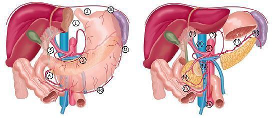 Cerrahi - Lenfadenektomi D1 mideye yapışık nodlar