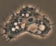 F. tularensis Dayanıklılık ve Ekoloji Hücre içi patojen Protozoonlar dahil bir çok canlıda yaşayabilme Doğa koşullarına dayanıklı Kenede ömür boyu (1-2 yıl), Sineklerde 14 gün