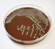 Bakterinin izolasyonu Bakterinin kültürü altın standarttır. Enfeksiyonun kesin tanısının konulmasını sağlar.