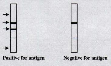 Lateral flow strip 5-10 dakika içerisinde pozitif/negatif cevap