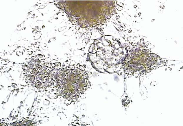 fertilizasyon ve klivaj oranlarına olumlu etkisinin mekanizması, hücreler arası iletişimin devam etmesi olarak yorumlanmaktadır (şekil 2). Şekil 2 : Petri kabında gelişiminin 3.