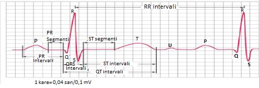 ġekil 5. Elektrokardiyografi ölçümleri (19) T dalgası: Ventriküllerin repolarizasyonunu yansıtır. Erişkinlerde normal T dalgasının süresi 0,10-0,25 sn dir.