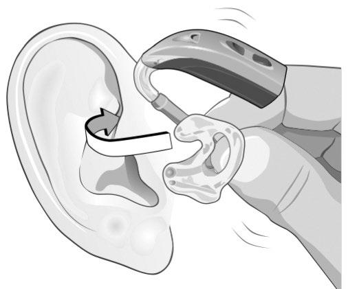 Adım 3a: Kulak kalıbı ile işitme cihazının takılması Sağ kulak kalıbını takarken, kulak kalıbını sağ elinizle tutun. Sol kulak kalıbını takarken, sol elinizle tutun.
