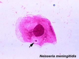 Neisseria meningitidis A B C A D X Y Z E 13 SEROGRUP B C Y