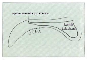 25 Şekil 2.1.6.2. Sert ve yumuşak damağın şematik çizimi A: sert ve yumuşak damağın klinik birleşimi, B: ah hattı, C: fovea palatinalar, D: sert ve yumuşak damağın anatomik birleşimi gösterilmektedir (12).