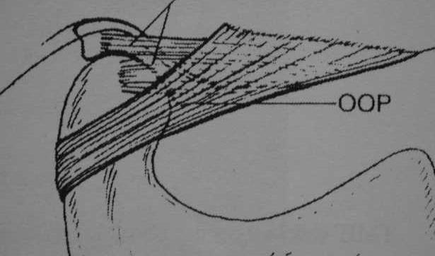 ġekil.2.3.temporomandibuler ligament (Yengin 2000).