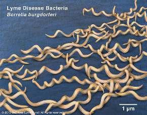 Borrelia spp. 0.2 0.