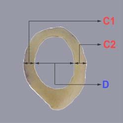 2. Femurun Boy (A), Corpus (B), Cortex (C1-C2) ve Medullar çapların (D) referans noktaları (Sağ medial yüz,