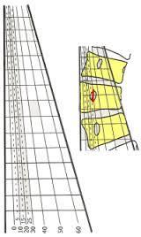 Şekil 24 Pedriolle torsiyometresi ile vertebra rotasyonu ölçümü (4) Evre 0: Her iki pedikül simetriktir.