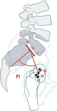 Pelvik tilt açısı; Femur başı orta noktasından geçen ve yere dik (ayakta çekilmiş lateral grafide) olan doğru ile yine femur başı orta noktasından ve sakral platonun orta