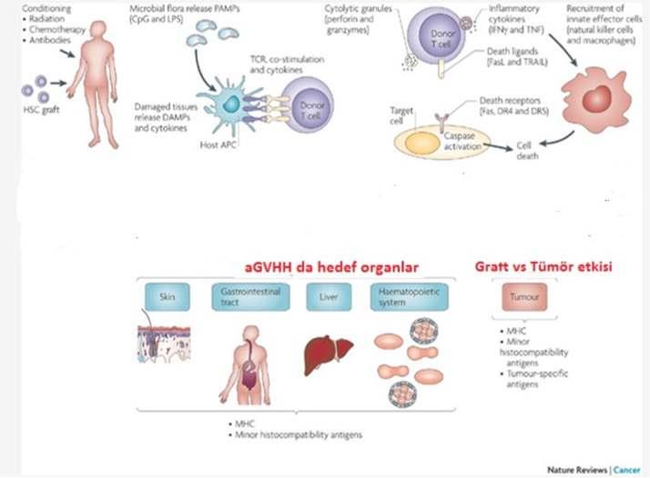 agvhd patogenezi Hazırlayıcı Rejim AML:Busul+Siklo HSCT