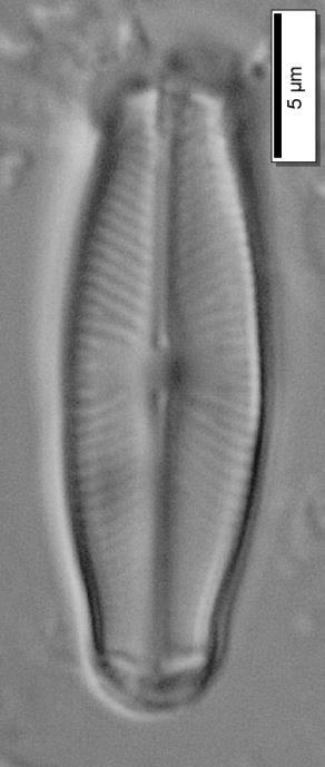 Sellaphora pupula (Kützing) Mereschkovsky (Navicula pupula Kützing) Kabuk Uzunluğu: 24-28 μm Kabuk Genişliği: 7-8 μm Şerit Yoğunluğu: 16-22 / 10 μm Ekolojisi: Ağır kirlilik