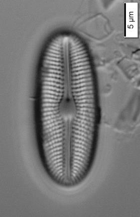 Diploneis elliptica (Kützing) Cleve (Navicula elliptica Kützing) Kabuk Uzunluğu: 20-37 μm Kabuk Genişliği: 11-18 μm Şerit Yoğunluğu: 10-14 / 10 μm Ekolojisi: Oligotrofik seviyedeki durgun sularda