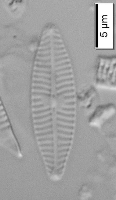 tatlısularda ve nispeten hafif acı sularda dağılım gösterir (Lange-Bertalot, 2001). Navicula veneta Kützing (Navicula cryptocephala var.