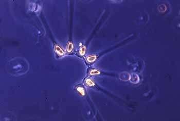 Plankton: mikroskopik hayvanlar ve