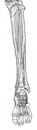 Lateral femoral kondilin inferolateralindeki bir çentiğe yapışır (şekil 4a).