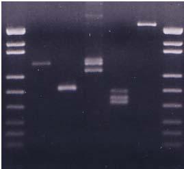Sütun 1/7: DNA Moleküler Ağırlık Markır Sütun 2: HumARA markır(255-315 bp) Sütun 3: HumTH01 markır (183-211 bp) Sütun 4: SE33 markır (234-318 bp) Sütun 5: vwf2 markır (100-200