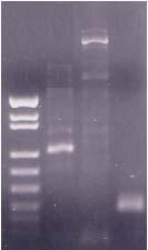 Sütun 1: Sütun 2: Sütun 3: Sütun 4: DNA Moleküler Ağırlık Markır YNZ22 markır (200-700 bp) 3 -HVR markır (200-700 bp) vwf1 markır (99-150 bp) Fig.