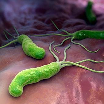 Helicobacter pylori (HP); dünya nüfusunun yaklaşık olarak yarısını çocukluk yaşlarından itibaren enfekte eden, spiral şekilli, gram (-), hareketli bir mikroorganizmadır.