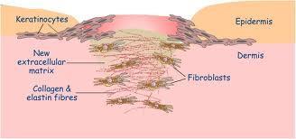 Proliferasyon fazı (Angioplazi & Fibroplazi, 6-14 gün) Fibroblast Kollajen
