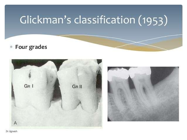 Glickman Sınıflaması Klas