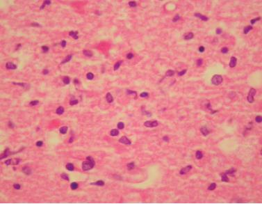 mikroglia, makrofaj ve lenfositlerin