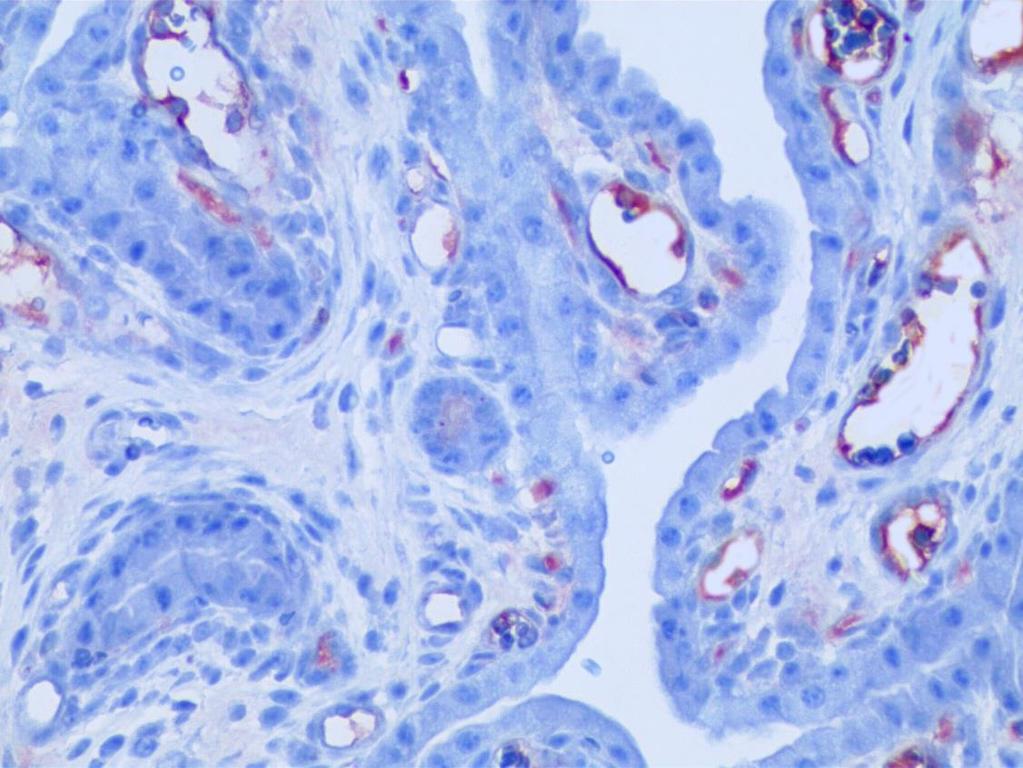 Hematoksilen zıt boyaması- ok başı: endometriyum epiteli, yıldız: endometriyum bezi), X400. Şekil 70.