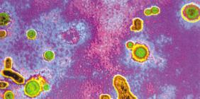 Şekil 1: HBV nin Elektron Mikroskopta Görünümü Hepatit B Virusu HBV, Hepadnaviridae ailesinin orthohepadnavirus cinsinde yer alan hepatotropik, zarflı ve kısmen çift sarmallı bir DNA virusudur.