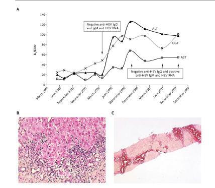 Gerolami R, et al.