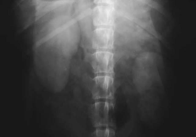 1. Arteriogram Bu faz oldukça kısadır 2.