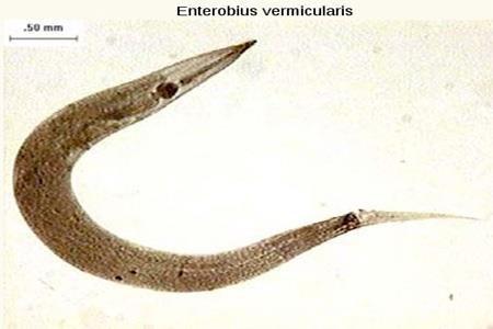 E. vermicularis; helmintlerden nematod ailesine mensup sık görülen bir parazit tipidir.