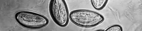 Enterobius Vermicularis Teşhis Yumurtaların 50 x 25 mikron büyüklüğünde, fasulye şeklinde görünümleri vardır.