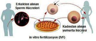 İnsanlarda döllenmiş yumurtada bulunan organellerden sentrozomun kaynağı sperm, mitokondrinin ve golginin kaynağı ise yumurtadır.