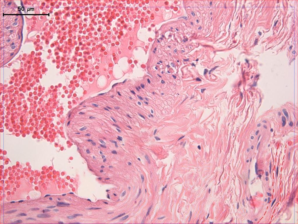 fib ICLC Fotoğraf 23. Tuba uterina dokusunda yapılan Hematoksilen-Eosin boyamasında; lamina propria daki gevģek bağ dokusu içerisinde fibroblast çekirdekleri ve ICLC ler görülüyor.