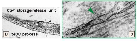 Şekil 7. A. Tuba Uterina daki ICLC de Yer Alan, Mitokondriyon + Kaveola + Endo(sarko)plazmik Retikulum İçeren Ca ++ Saklama-Serbestleştirme Birimi nin TEM Görüntüsü B.