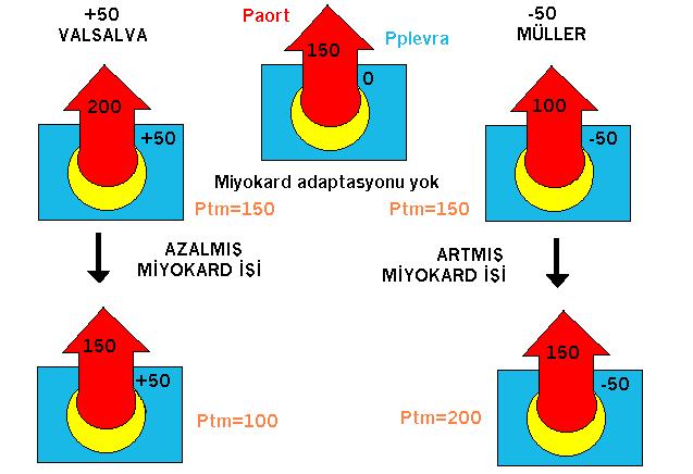 Şekil 3. Pozitif basınçlı ventilasyonun kalp fonksiyonuna etkisi. P tm : sol ventrikül transmüral basıncı, P aort :aort basıncı, P plevra : Plevra basıncı.