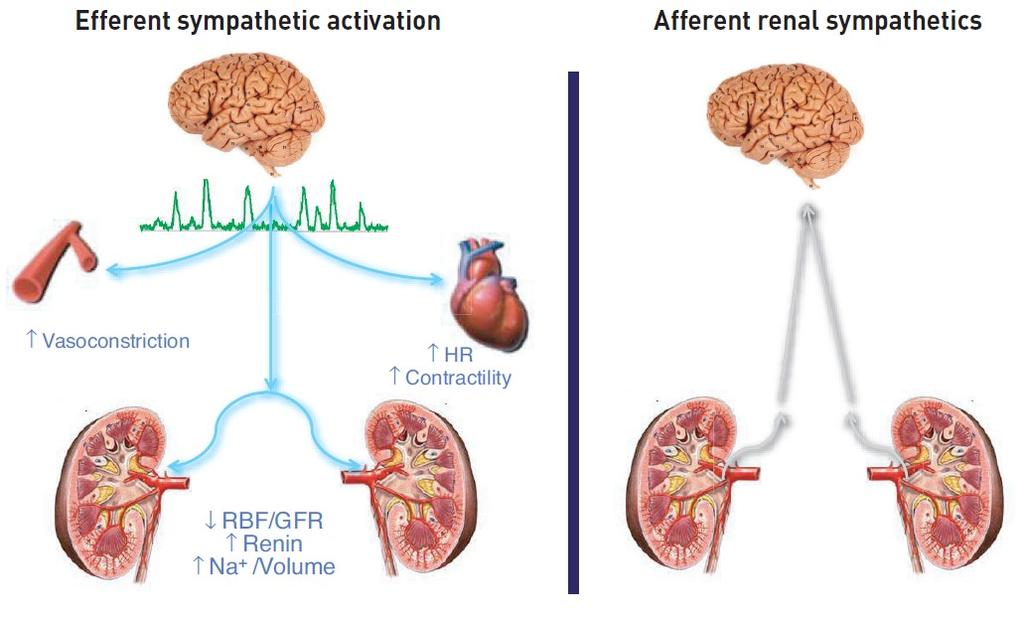 RBF: Renal Blood Flow(Renal kan akımı) Sempatik sinir sistemi jukstaglomerüler aparattan renin salınımını artırır. DiBona GF.