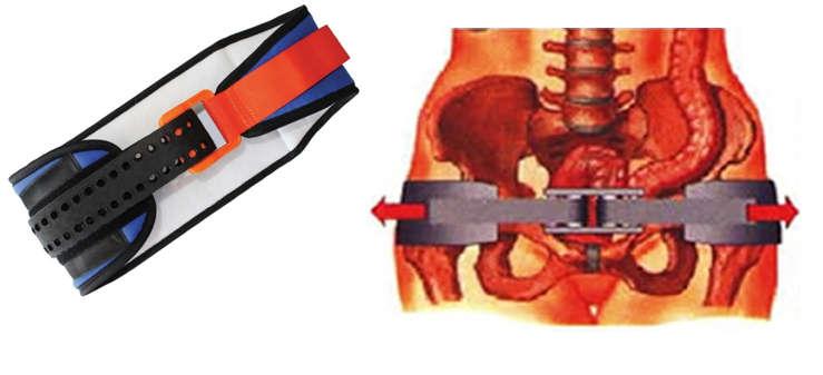 6 Pelvis Kemeri Pelvis kemerlerinin direkt sıkıştırma veya hava basıncı yöntemi ile uygulanan farklı tipleri mevcuttur.