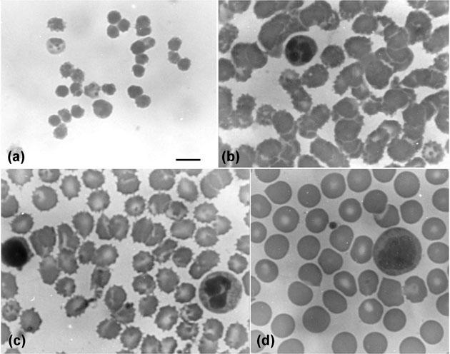 Kan Hücreleri Üzerine etki The picture of peripheral blood smears (Bar: 10
