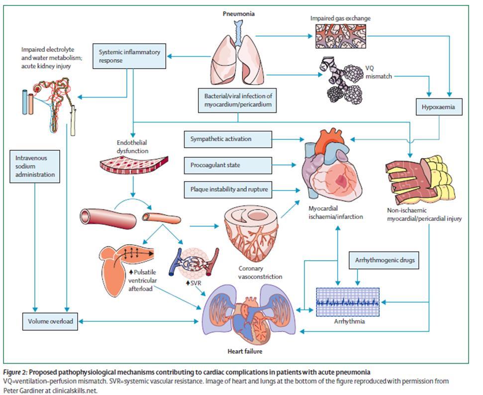 Pnömoni komplikasyonları, kardiyovasküler sistemi ve