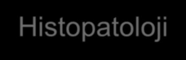 Histopatoloji Grup 1 (n=22) Grup 2 (n=12) Kortikal adenom 18 4 Adrenal kist 0 4 Feokromositoma* 1 1 Kortikal karsinom 1 2 Dejenere Schwannoma 1 0 Primer pigmente nodüler adenokortikal