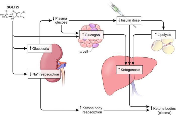 DKA Mekanizması SGLT-2 proteini pankreas α hücrelerinde +, SGLT-2 inhibitörleri glukagon salınımını artırır SGLT-2 inhibitörleri 3-OH-butirat ve asetoasetatın böbrekten atılmasını azaltarak ketoz